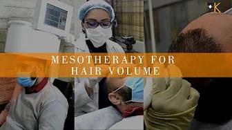 Mesotherapy For Hair | Mesotherapy For Hair Volume | Dr Aman Dua