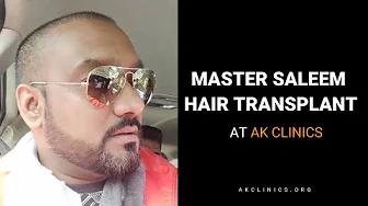 Master Saleem Hair Transplant | Celebrity Hair Transplant | Dr Kapil Dua